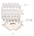 2024년 8월 22일 (목) 16:23 판의 섬네일